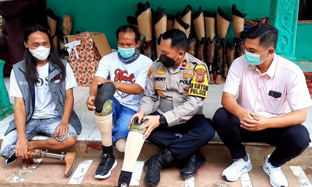 Kisah, Korban Tabrak Kereta, Kaki Palsu, Melangkah